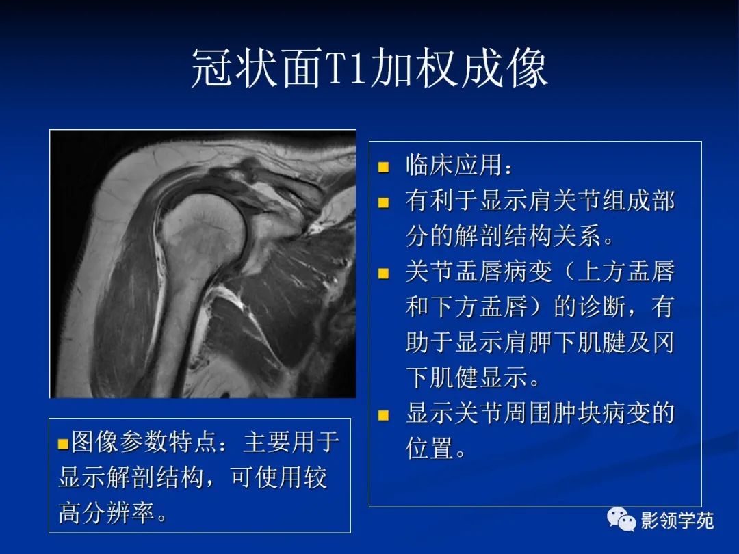 影像PPT - 肩袖解剖及损伤的临床及MRI诊断-127 影像PPT - 肩袖解剖及损伤的临床及MRI诊断-127