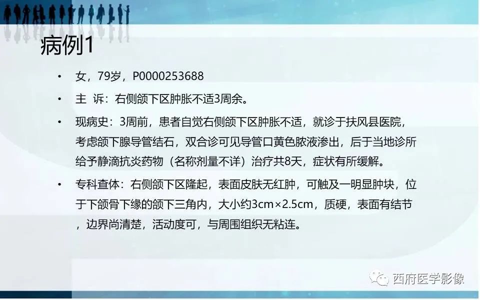 影像PPT - 【PPT】涎石症的影像诊断-2