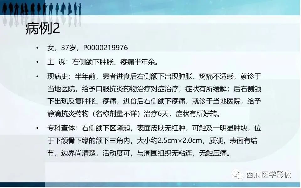 影像PPT - 【PPT】涎石症的影像诊断-5