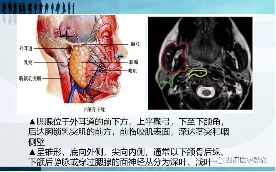 影像PPT - 【PPT】涎石症的影像诊断-13