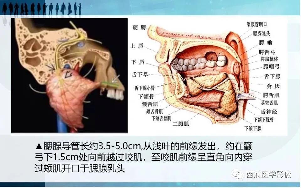 影像PPT - 【PPT】涎石症的影像诊断-14