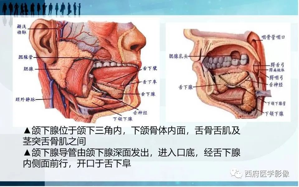 影像PPT - 【PPT】涎石症的影像诊断-15