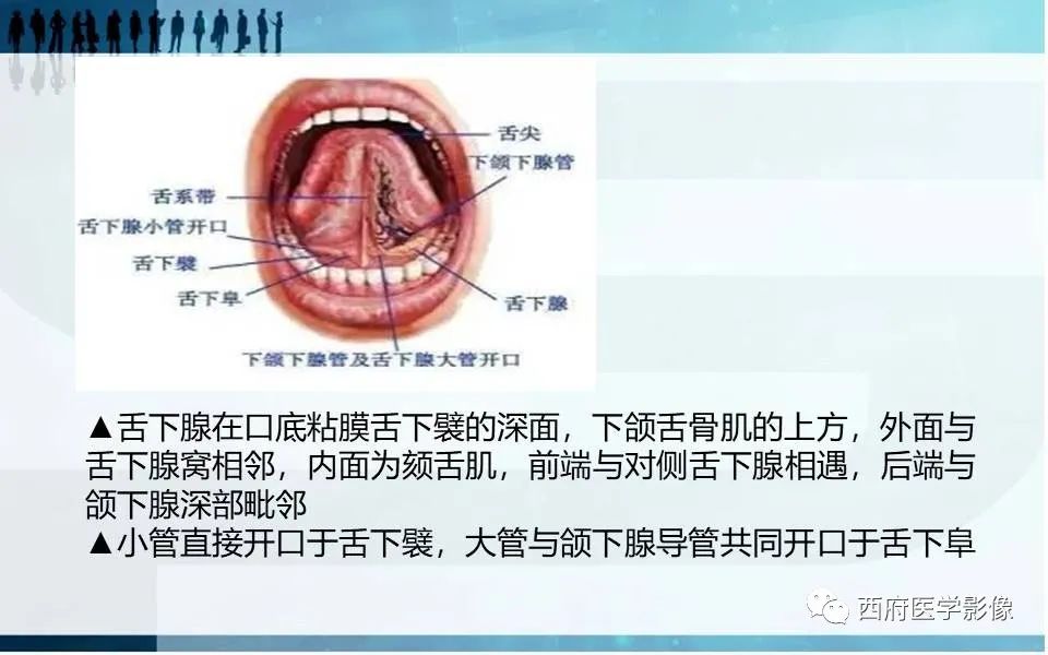 影像PPT - 【PPT】涎石症的影像诊断-16