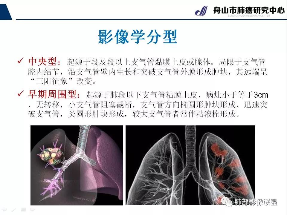 影像PPT - 【PPT】早期肺鳞癌----容易忽视的影像学表现-3