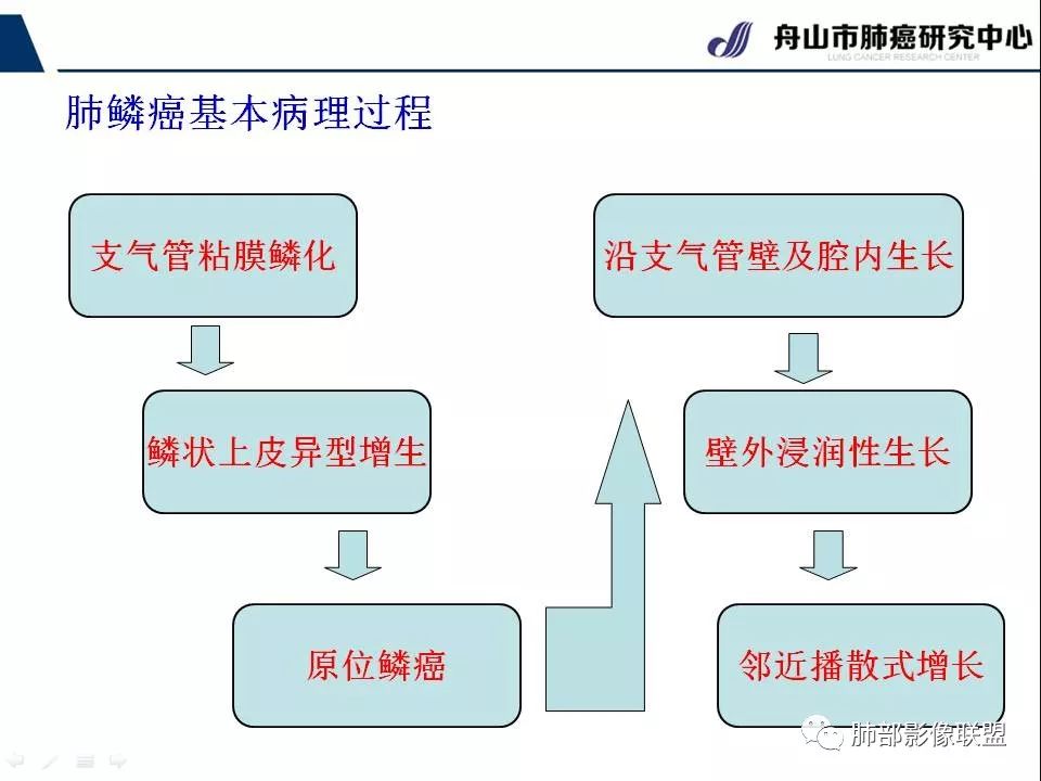 影像PPT - 【PPT】早期肺鳞癌----容易忽视的影像学表现-7