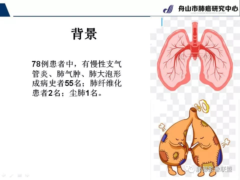 影像PPT - 【PPT】早期肺鳞癌----容易忽视的影像学表现-63