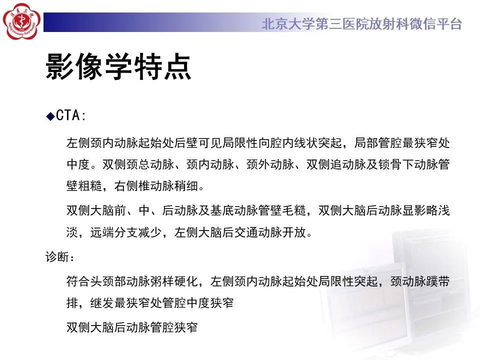影像PPT - 【PPT】颈动脉蹼-8