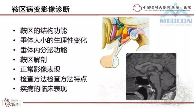 影像PPT - 【PPT】鞍区肿瘤性病变的影像诊断思路-2