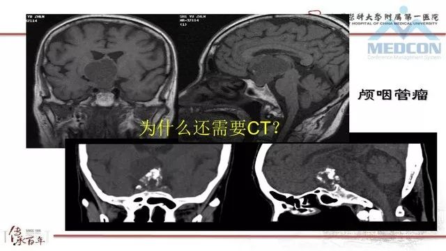 影像PPT - 【PPT】鞍区肿瘤性病变的影像诊断思路-5