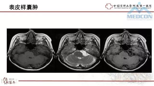 影像PPT - 【PPT】鞍区肿瘤性病变的影像诊断思路-35