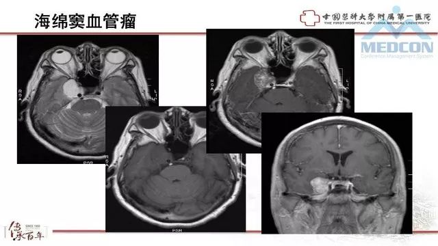 影像PPT - 【PPT】鞍区肿瘤性病变的影像诊断思路-39