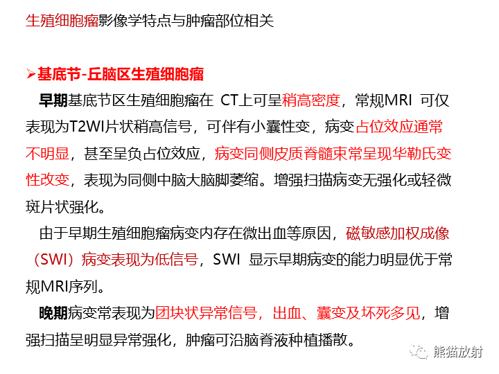 影像PPT - 【病例】颅内生殖细胞瘤2例MR-22