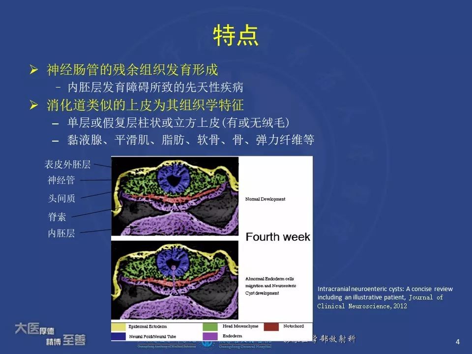 影像PPT - 【PPT】颅内神经肠源性囊肿-2