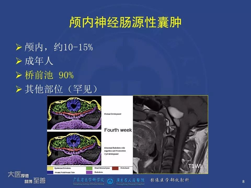 影像PPT - 【PPT】颅内神经肠源性囊肿-6
