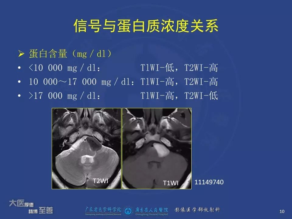 影像PPT - 【PPT】颅内神经肠源性囊肿-8