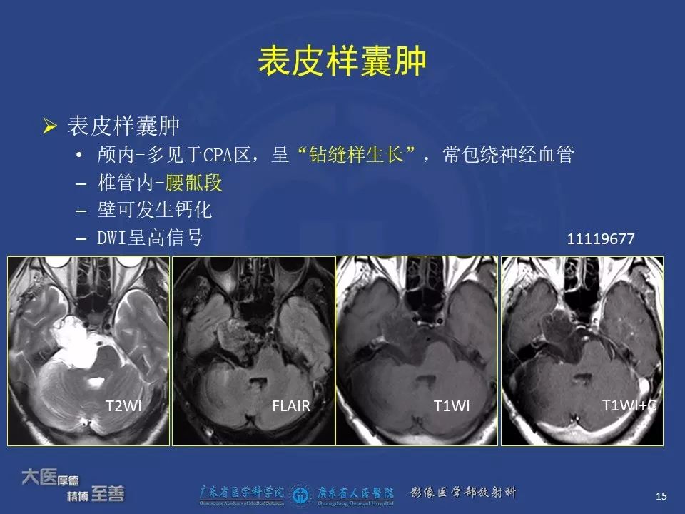 影像PPT - 【PPT】颅内神经肠源性囊肿-13