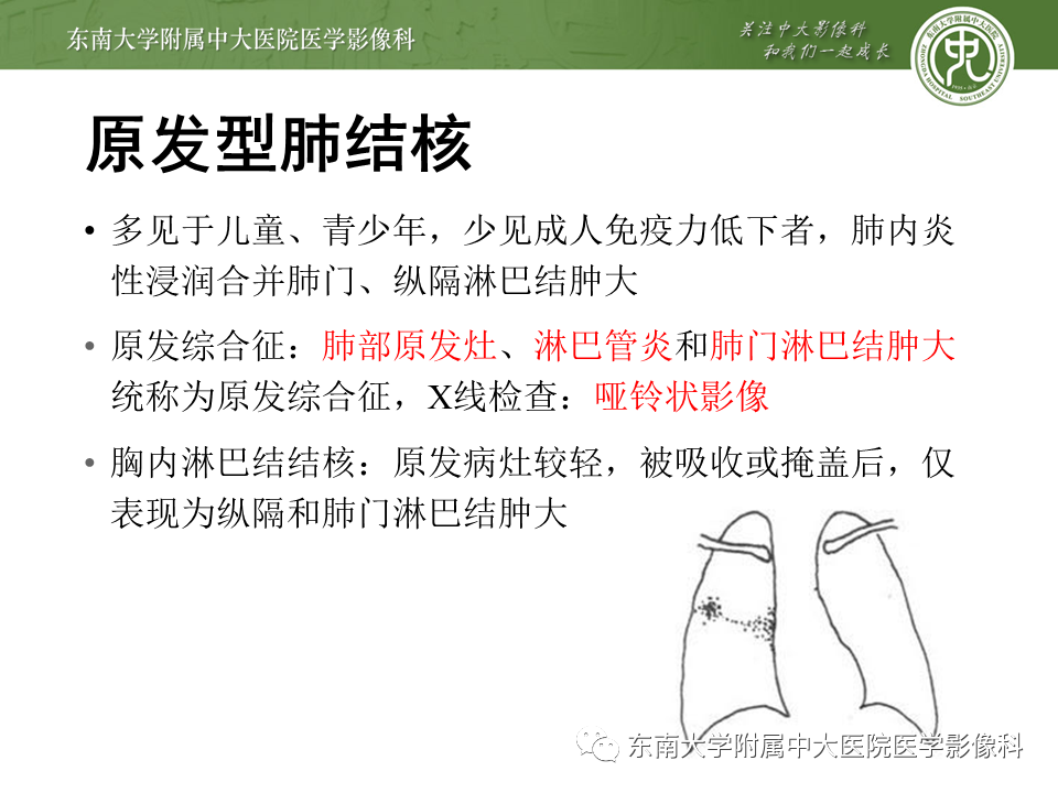 影像PPT - 【PPT】肺结核影像表现及鉴别-5
