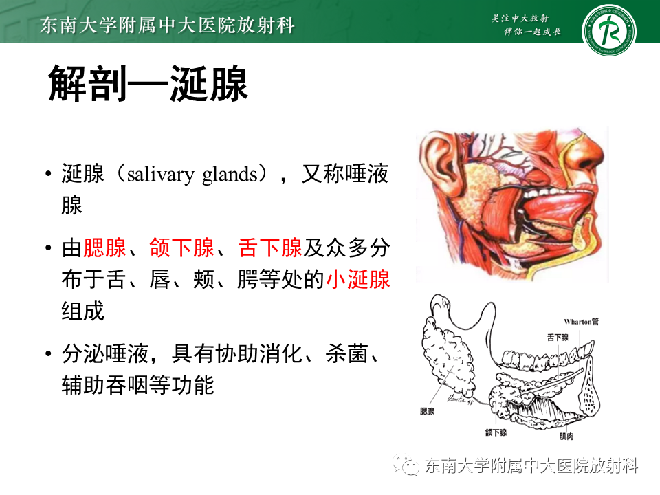 影像PPT - 【PPT】腮腺腺淋巴瘤的影像-4 影像PPT - 【PPT】腮腺腺淋巴瘤的影像-4