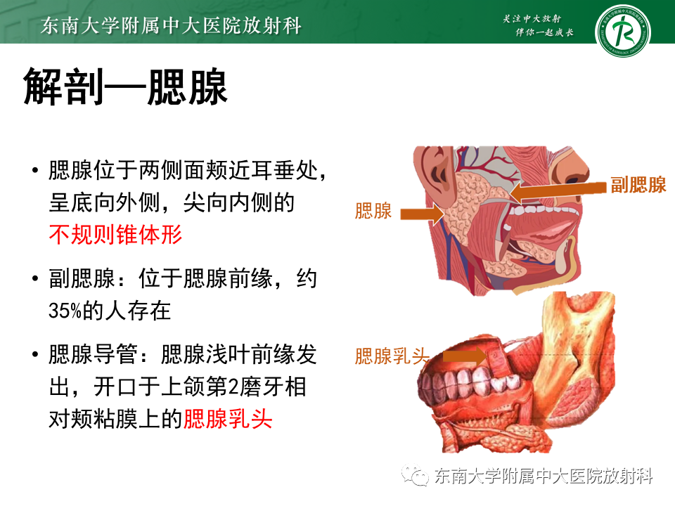 影像PPT - 【PPT】腮腺腺淋巴瘤的影像-5 影像PPT - 【PPT】腮腺腺淋巴瘤的影像-5