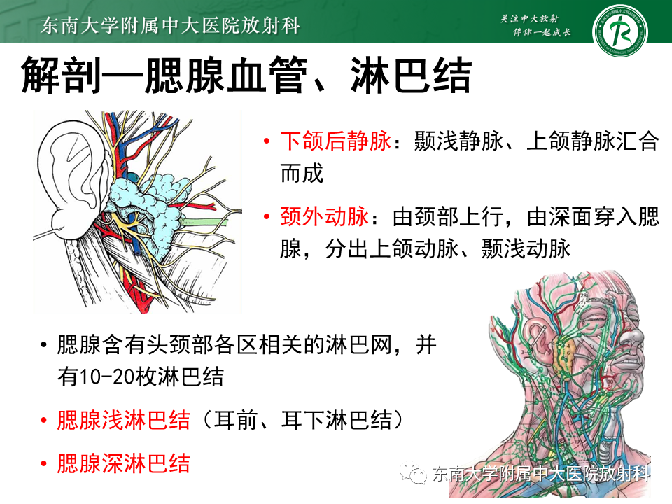 影像PPT - 【PPT】腮腺腺淋巴瘤的影像-7 影像PPT - 【PPT】腮腺腺淋巴瘤的影像-7