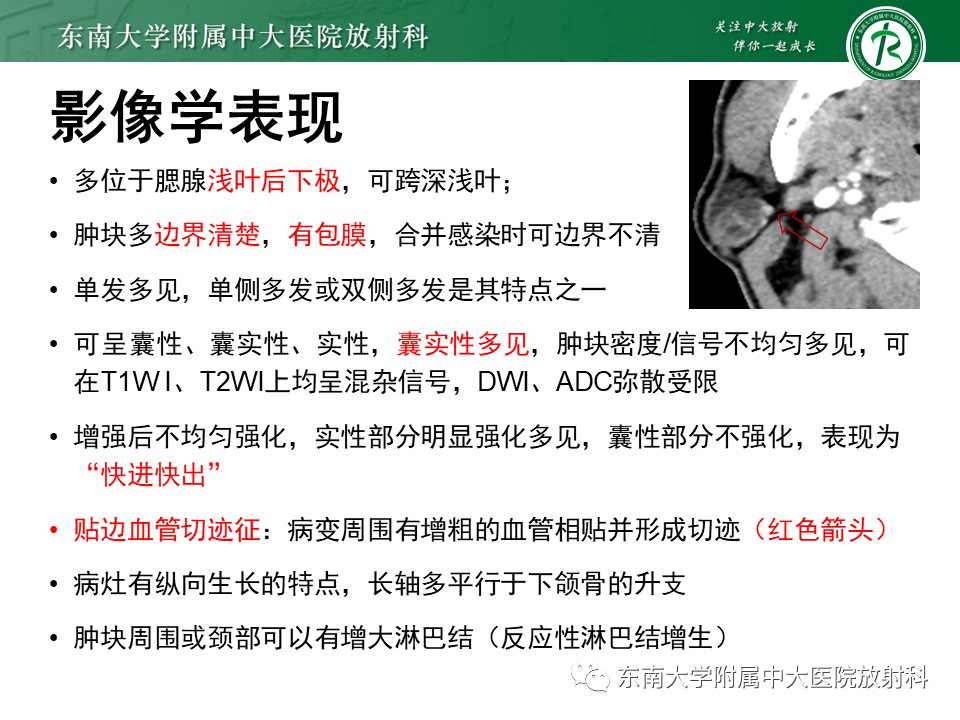 影像PPT - 【PPT】腮腺腺淋巴瘤的影像-14 影像PPT - 【PPT】腮腺腺淋巴瘤的影像-14