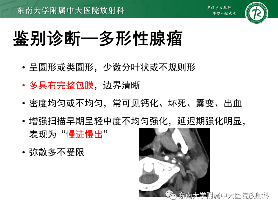 影像PPT - 【PPT】腮腺腺淋巴瘤的影像-16 影像PPT - 【PPT】腮腺腺淋巴瘤的影像-16
