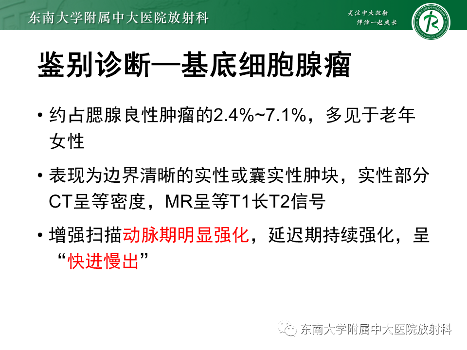 影像PPT - 【PPT】腮腺腺淋巴瘤的影像-20 影像PPT - 【PPT】腮腺腺淋巴瘤的影像-20