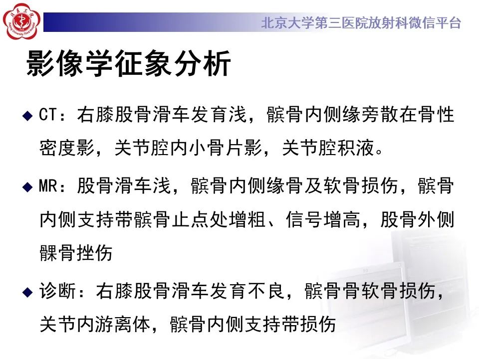 影像PPT - 【PPT】髌骨脱位的影像-8