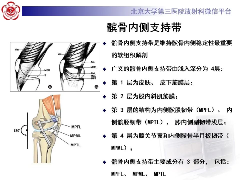 影像PPT - 【PPT】髌骨脱位的影像-13