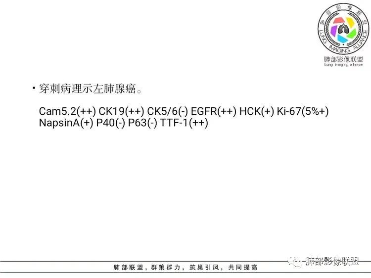 影像PPT - 【病例】 这样的肺腺癌防不胜防-15 影像PPT - 【病例】 这样的肺腺癌防不胜防-15