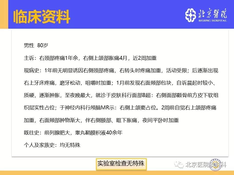 影像PPT - 【PPT】鼻窦未分化多形性肉瘤影像诊断-2
