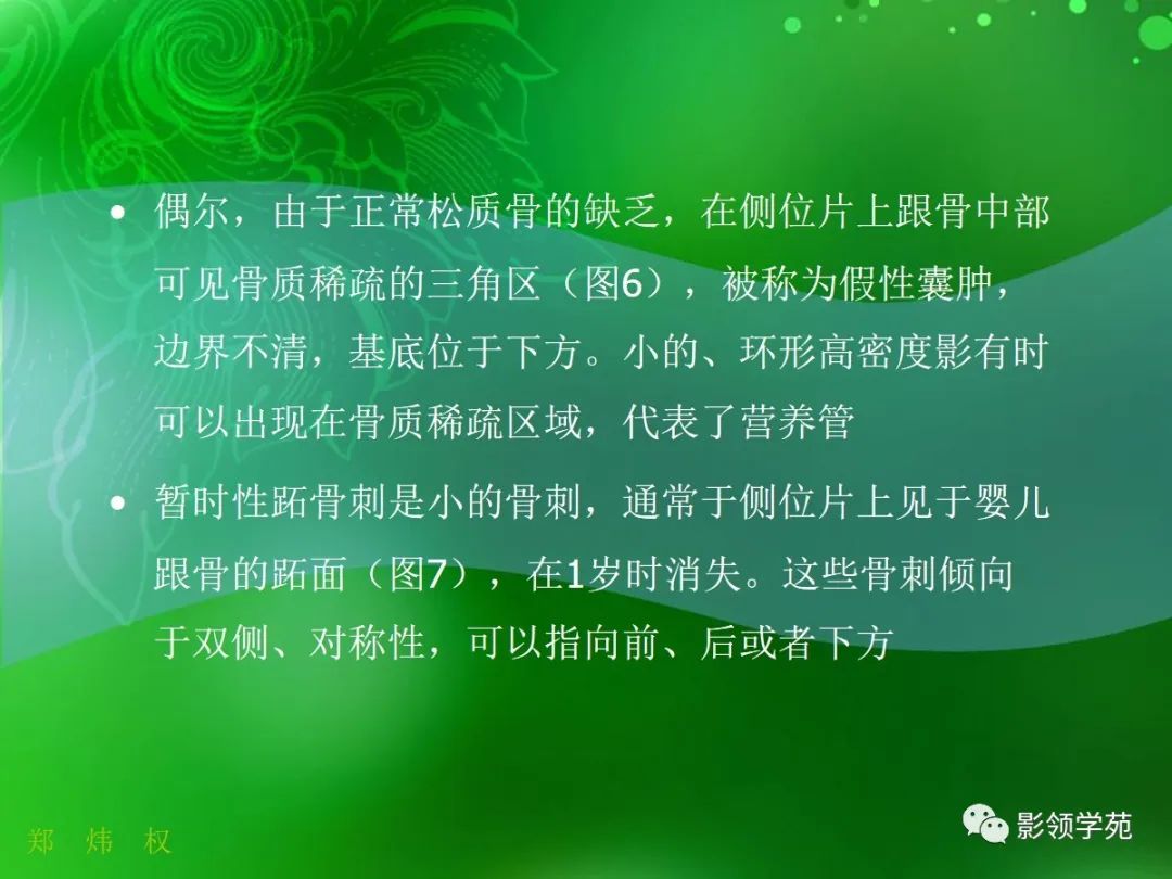 影像PPT - 【PPT】跟骨:正常与变异-5 影像PPT - 【PPT】跟骨:正常与变异-5