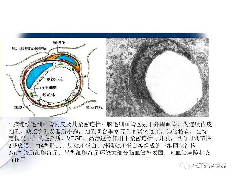 影像PPT - 【PPT】脑肿瘤基础：血脑屏障、强化、水肿-4