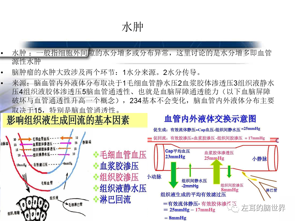 影像PPT - 【PPT】脑肿瘤基础：血脑屏障、强化、水肿-6