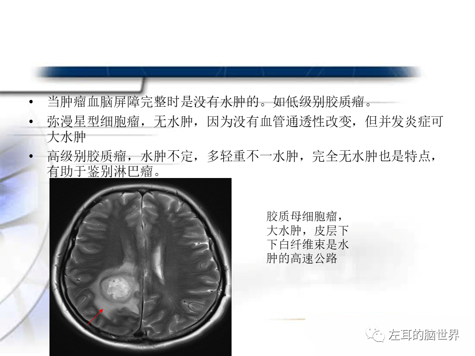 影像PPT - 【PPT】脑肿瘤基础：血脑屏障、强化、水肿-8