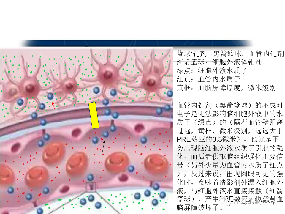 影像PPT - 【PPT】脑肿瘤基础：血脑屏障、强化、水肿-16