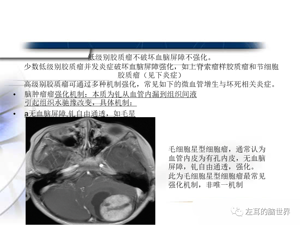 影像PPT - 【PPT】脑肿瘤基础：血脑屏障、强化、水肿-17