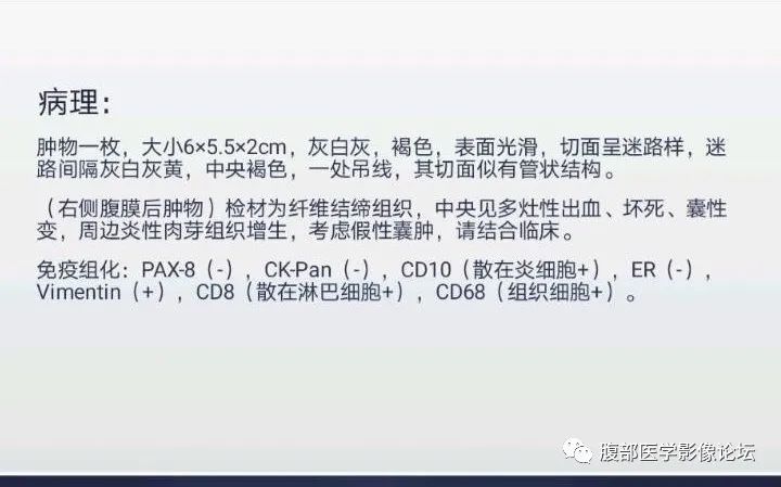 影像PPT - 【病例】腹膜后假性囊肿1例CT影像-5
