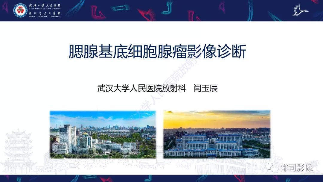 影像PPT - 【PPT】腮腺基底细胞腺瘤影像诊断-1