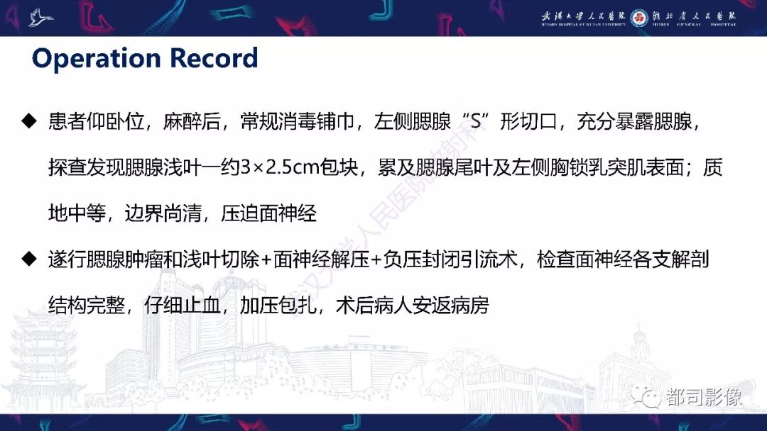 影像PPT - 【PPT】腮腺基底细胞腺瘤影像诊断-4