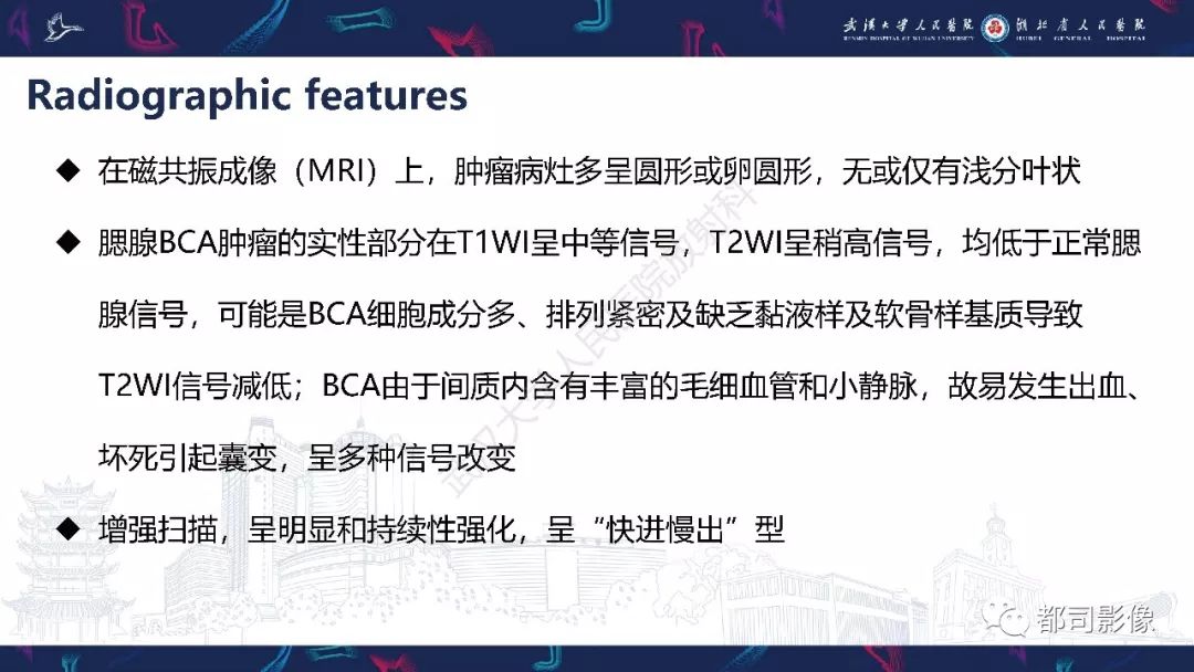 影像PPT - 【PPT】腮腺基底细胞腺瘤影像诊断-16