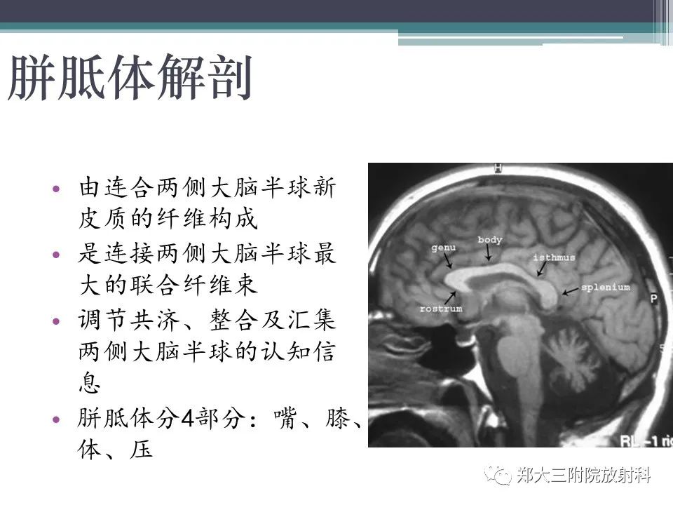 影像PPT - 【PPT】胼胝体病变的诊断思路-3