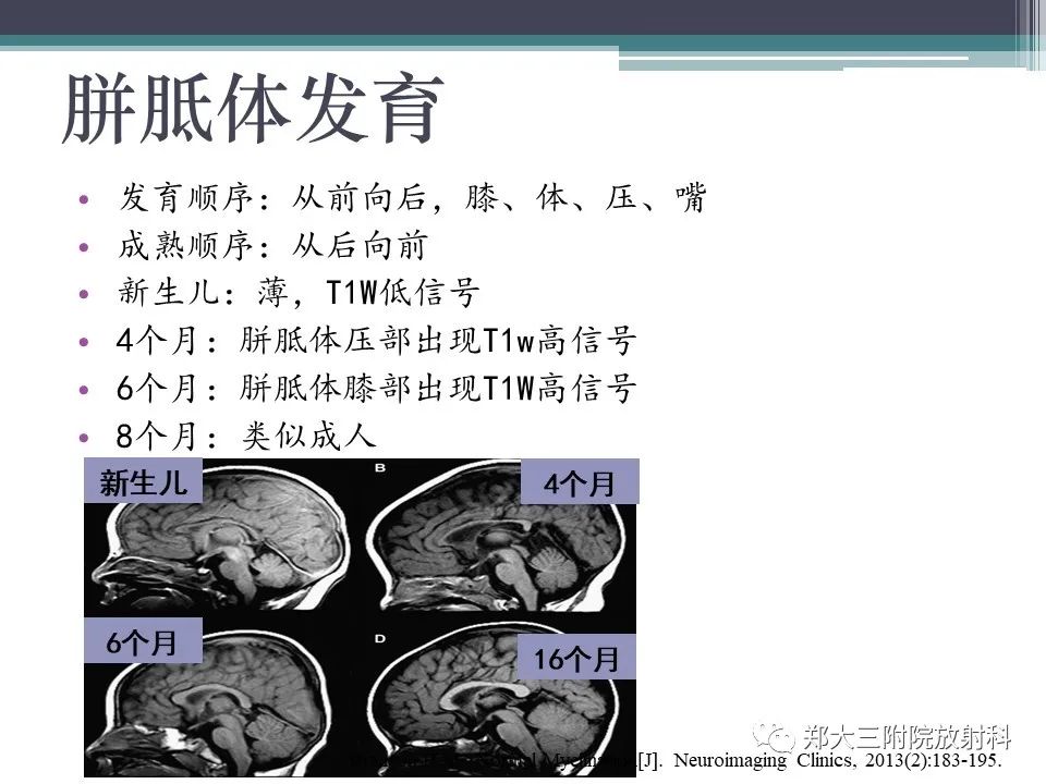 影像PPT - 【PPT】胼胝体病变的诊断思路-4
