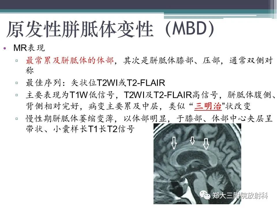 影像PPT - 【PPT】胼胝体病变的诊断思路-7