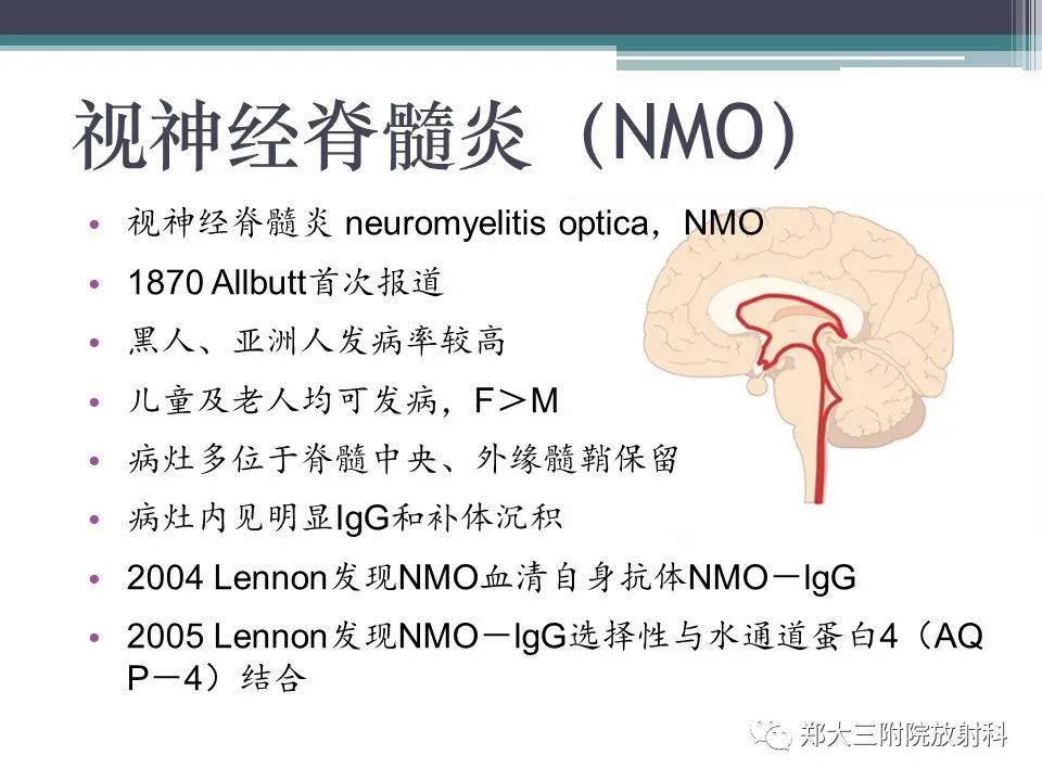 影像PPT - 【PPT】胼胝体病变的诊断思路-26