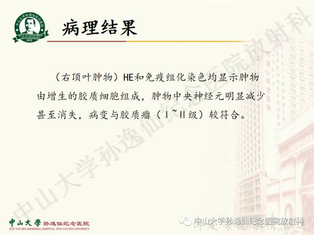 影像PPT - 【病例】囊性胶质瘤1例MR影像-10