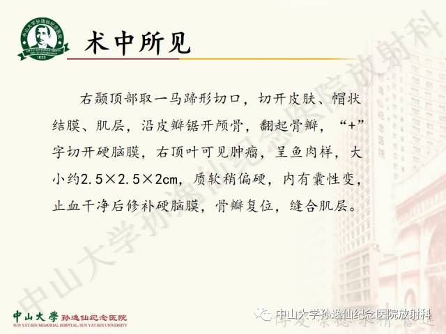 影像PPT - 【病例】囊性胶质瘤1例MR影像-9
