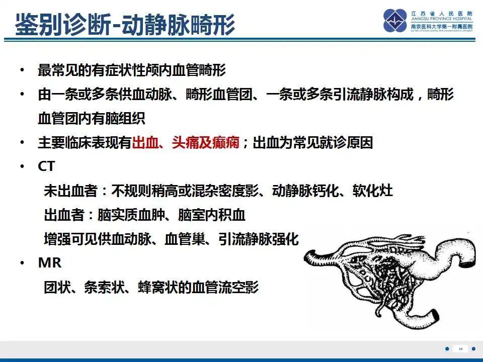 影像PPT - 【PPT】Sturge-Weber综合症-32