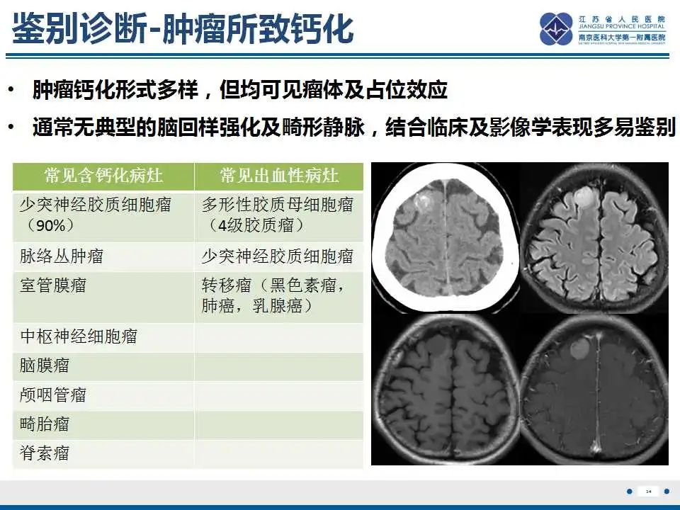 影像PPT - 【PPT】Sturge-Weber综合症-36