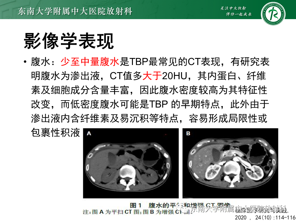 影像PPT - 【PPT】结核性腹膜炎-9